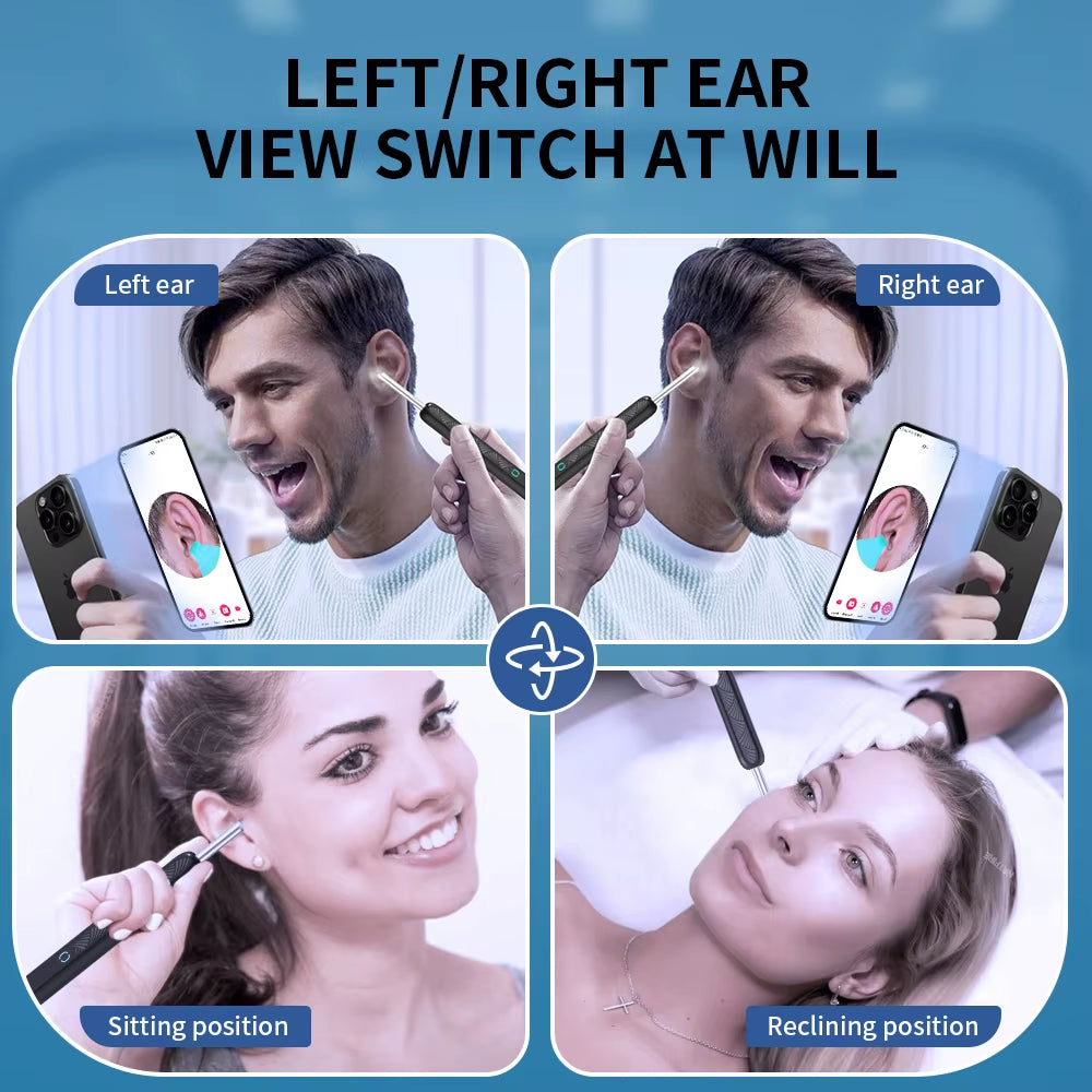Dropshipping Ear Cleaner with Camera Wireless Ear Sticks Otoscope USB C Charging Endoscope Wax Removal Tool Earpick Mini Camera